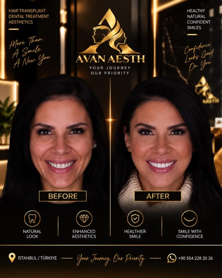 Dental treatment before and after – example 3
