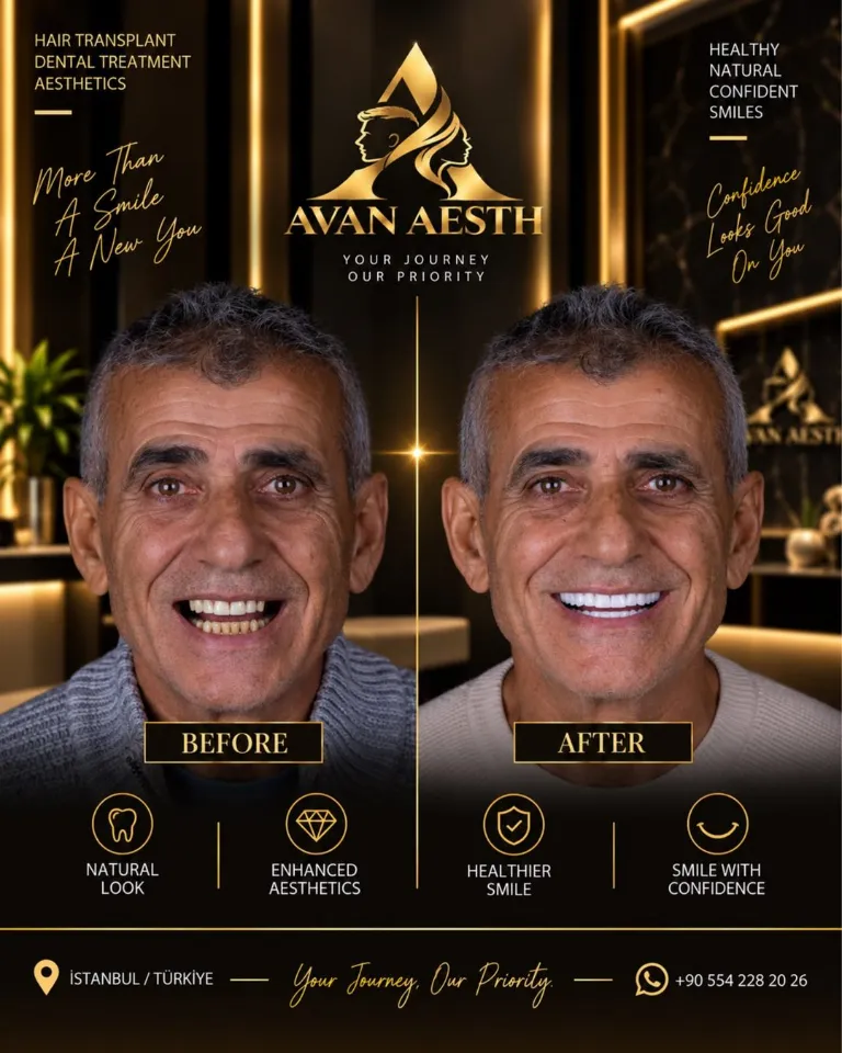Dental treatment before and after – example 5