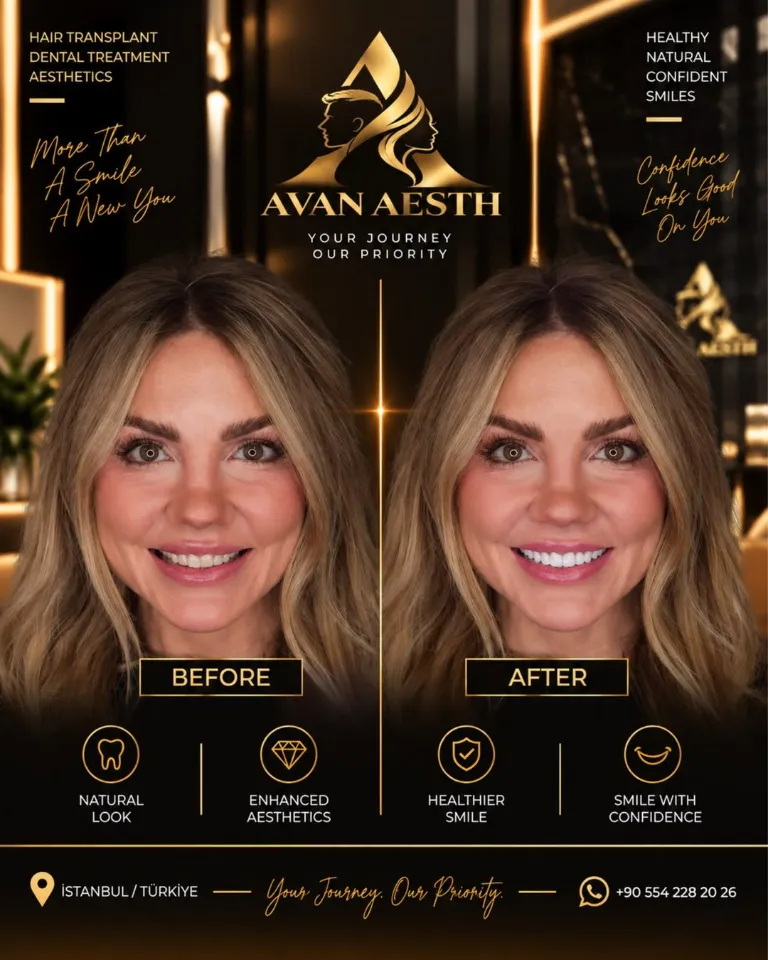 Dental treatment before and after – example 6