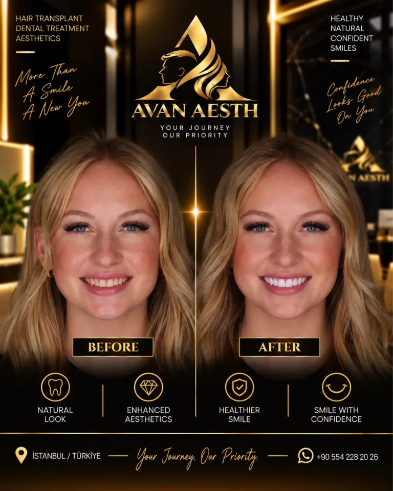 Dental treatment before and after – example 8