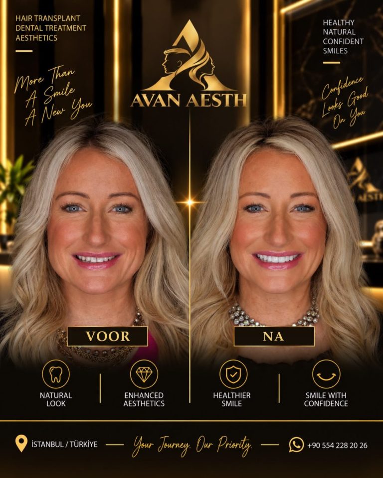 Tandheelkundige behandeling voor en na – voorbeeld 1