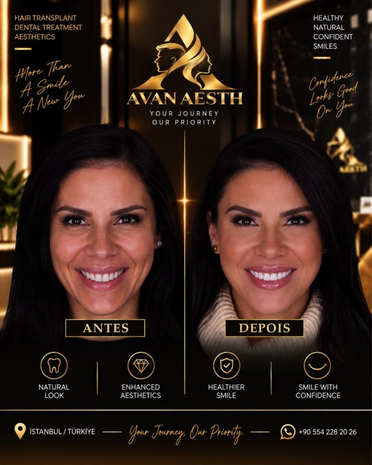 Tratamento dentário antes e depois – imagem 3