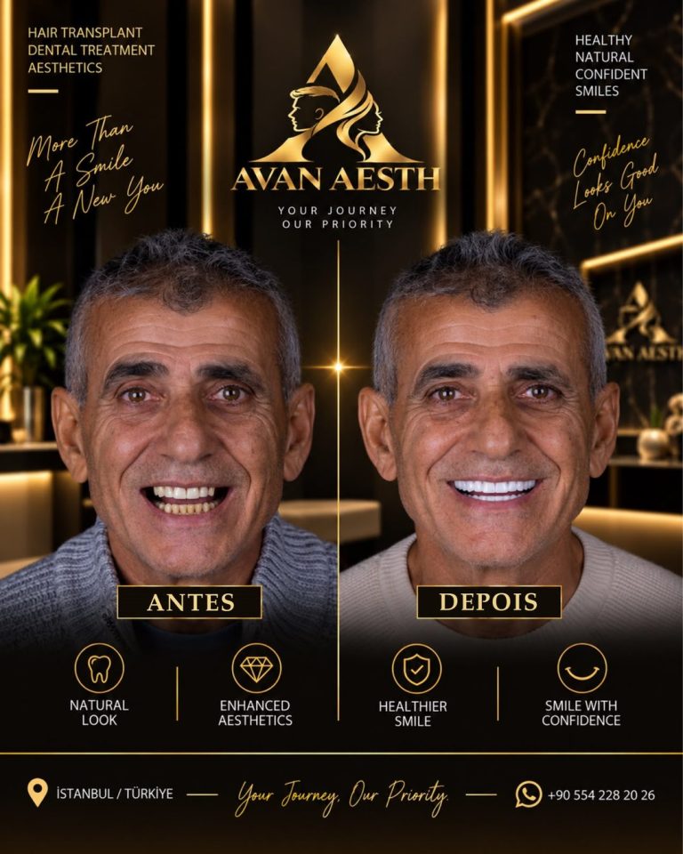 Tratamento dentário antes e depois – imagem 5
