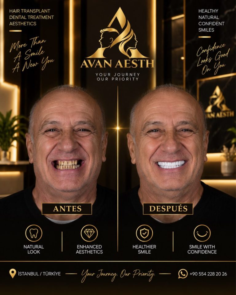Tratamiento dental antes y después – ejemplo 2