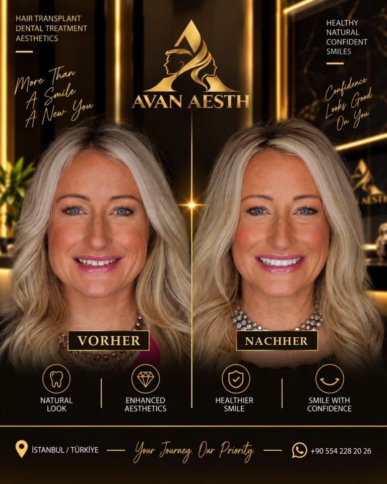 Zahnbehandlung vorher und nachher – Beispiel 1